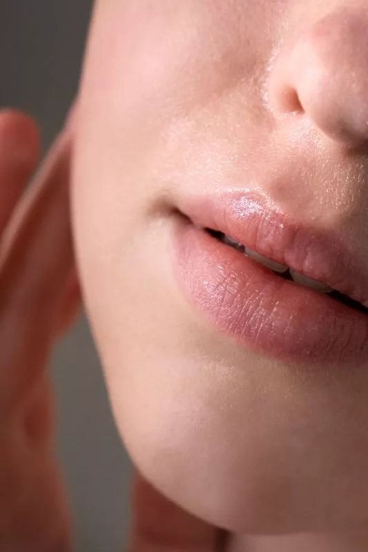 labios quemados y como cuidarlos